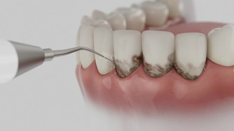 Reliable Dental Implants contractor in Anderson County County, TN by Dentist Open Now
